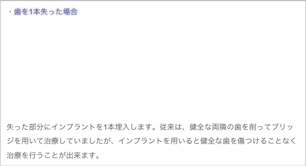 ・歯を1本失った場合










失った部分にインプラントを1本埋入します。従来は、健全な両隣の歯を削ってブリッジを用いて治療していましたが、インプラントを用いると健全な歯を傷つけることなく治療を行うことが出来ます。